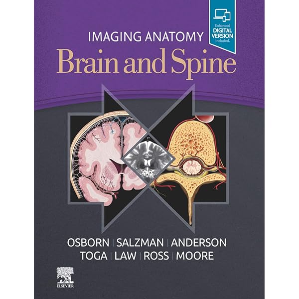 Amazon.com: Osborn's Brain E-Book eBook : Osborn MD, FACR, Anne G